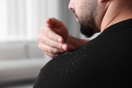 Șampon anti-mătreață: cum funcționează ingredientele active (P)