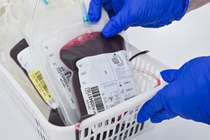 Pacient decedat dupa o transfuzie cu sange incompatibil Asistent ATI trimis in judecata pentru omor din